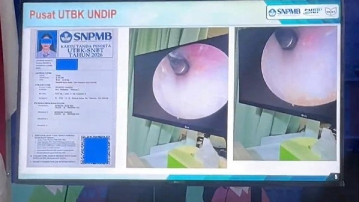 Viral! Peserta UTBK Diduga Tanam Alat di Telinga